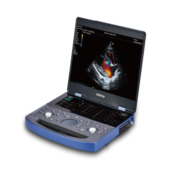 Vetus E7 - Hand-Carried Veterinary Ultrasound System